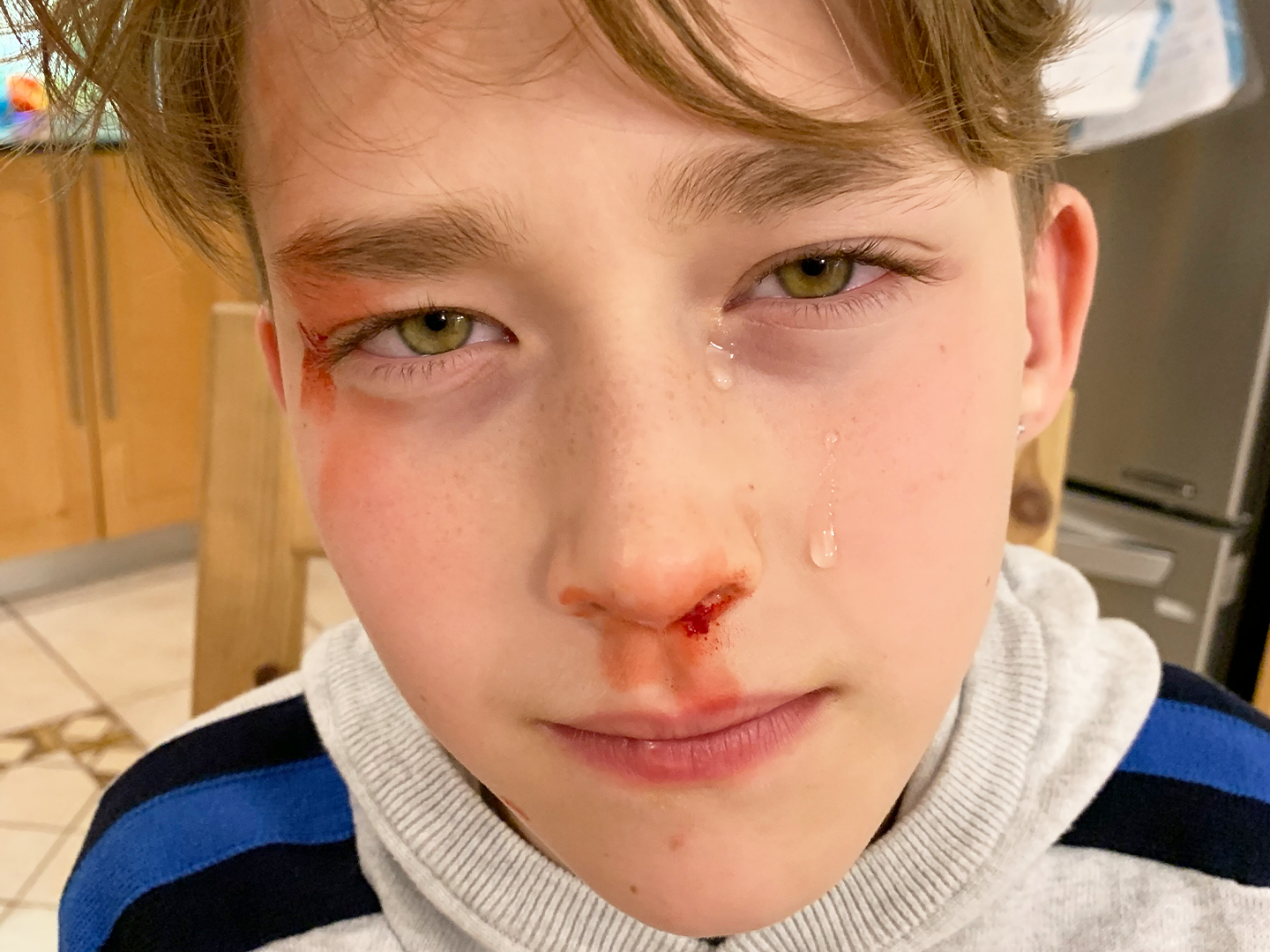 מדמה דמעות וזיעה לאיפור אפקטים מקצועי של בועז שטיין